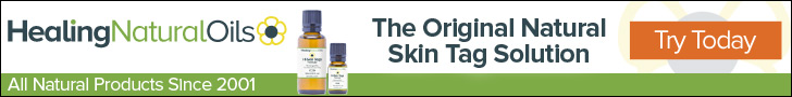Remove skin tags naturally