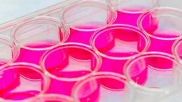 Stem Cells Bone Regeneration