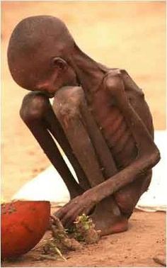 African child starving. Photo - tenthcrusade, via Flickr